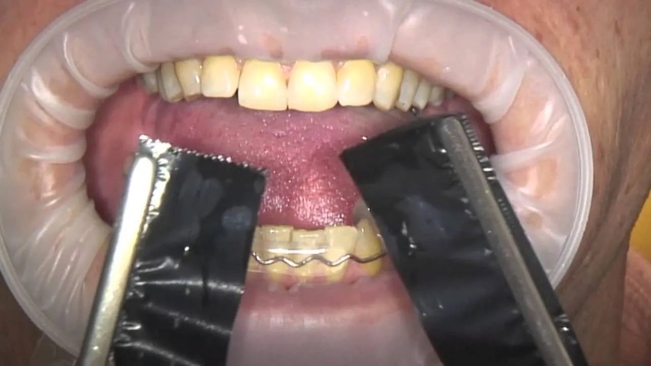 Bausch Arti Fol Metallic Shimstock Flim 12µ Microns