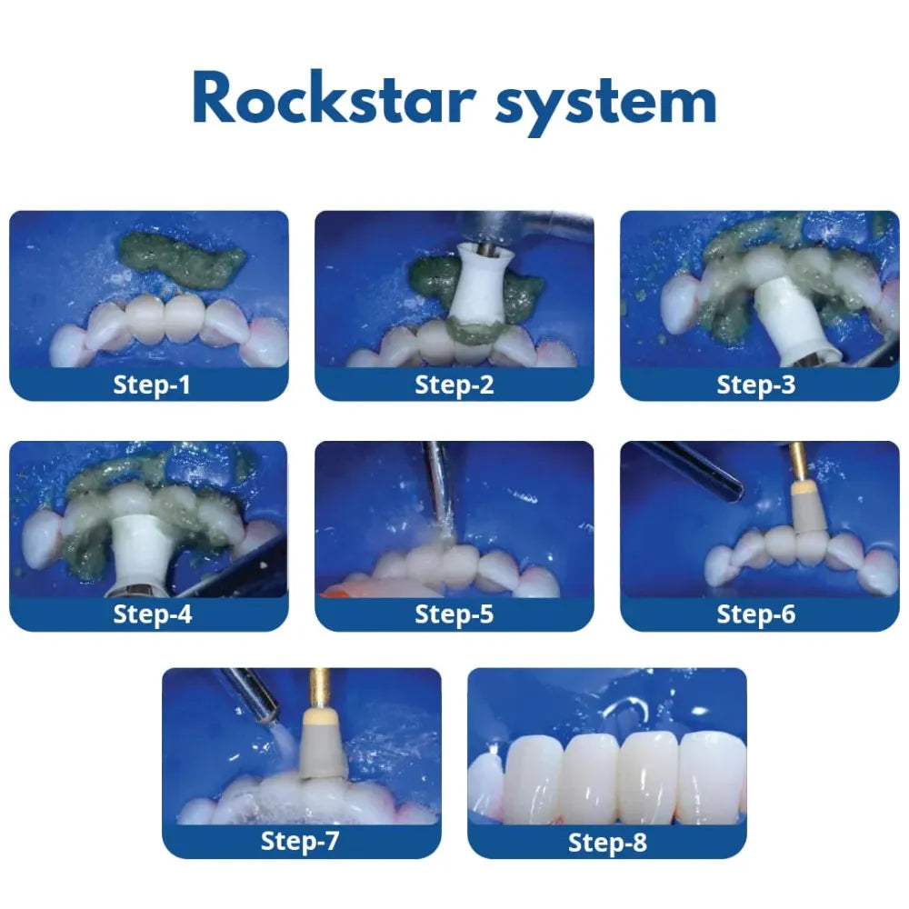 Bioclear Rockstar Polisher Kit
