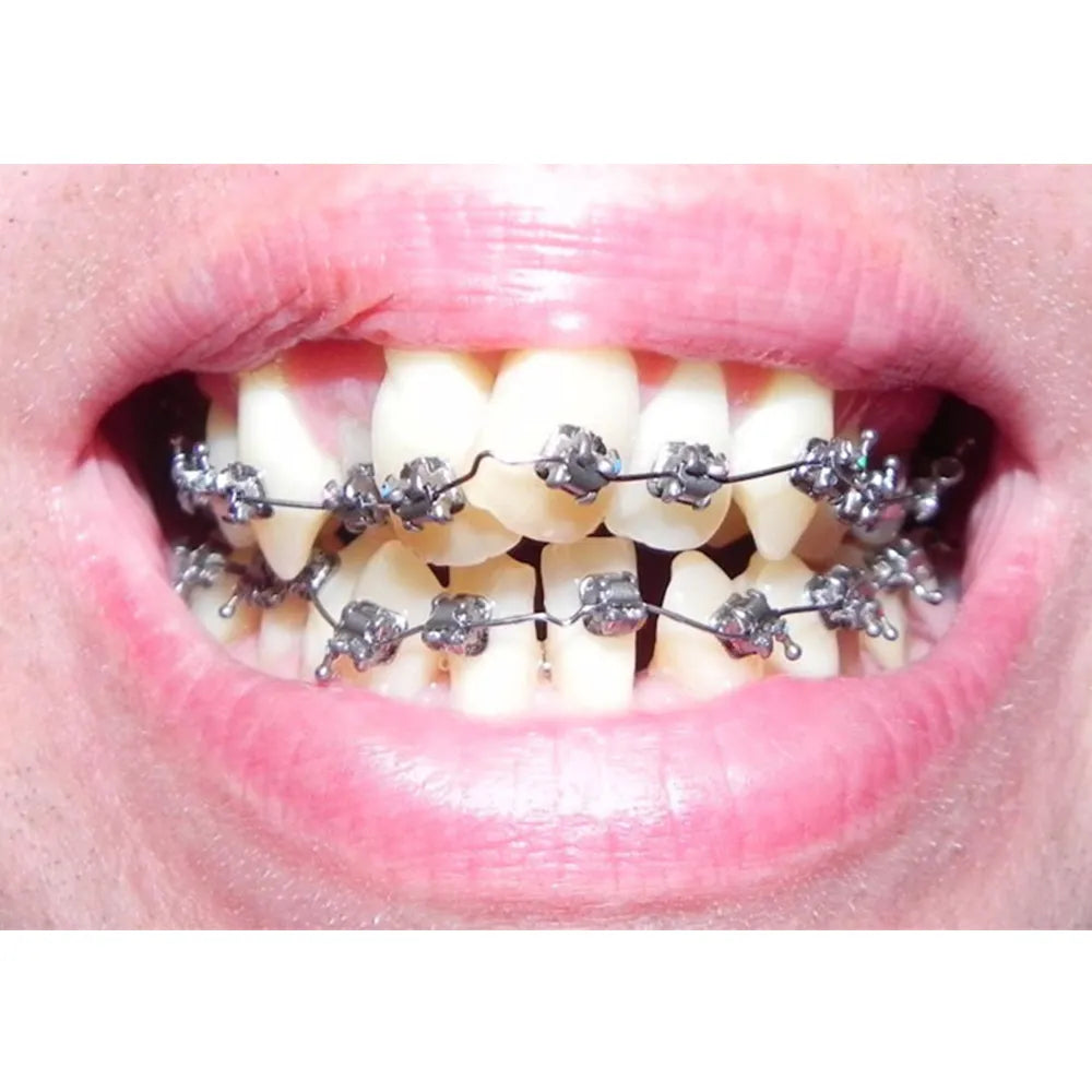 D-Tech Precimax (MIM MBT Prescription Brackets)