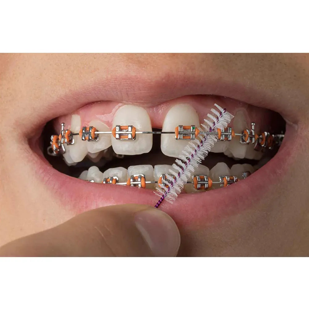 D-Tech Precimax (MIM MBT Prescription Brackets)