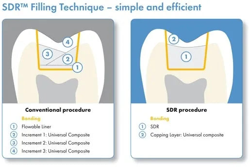 Dentsply SDR Plus Flowable Bulk Filling Material