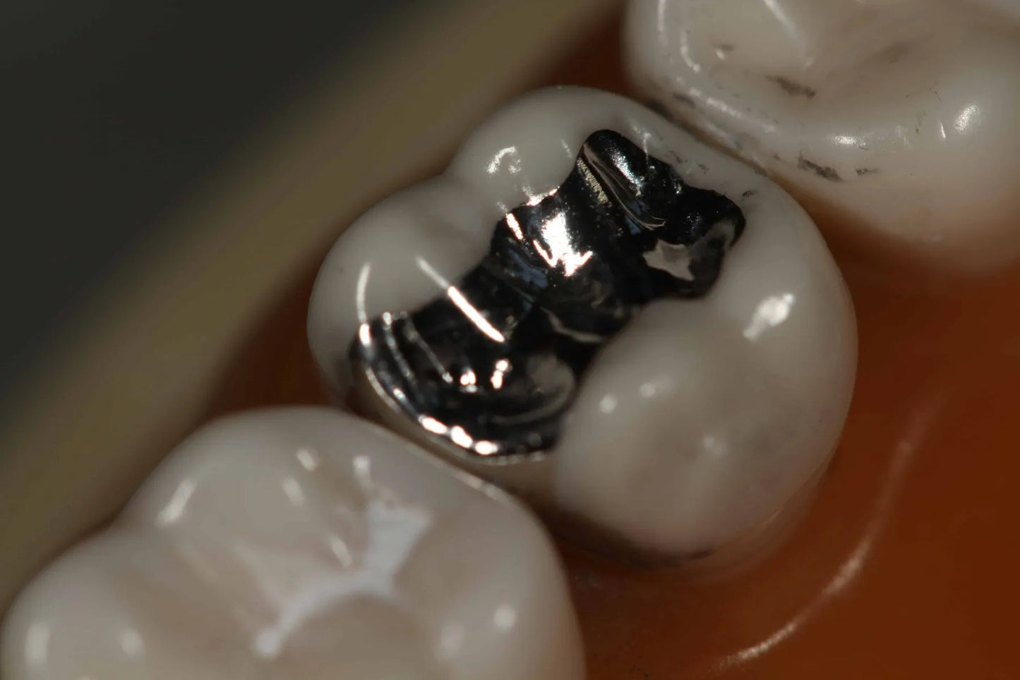 Dpi Fine Grain Silver Alloy