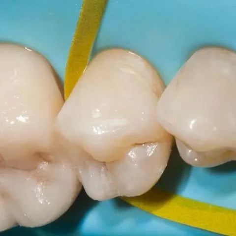 Eve Flexi Strips 9010