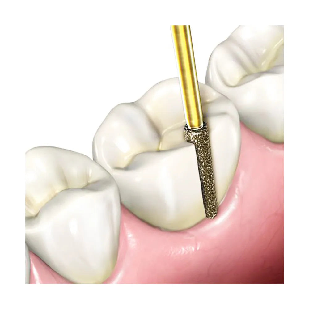 Frank Dental Taper Fissure Diamond Bur FG - TF (Made in Germany)
