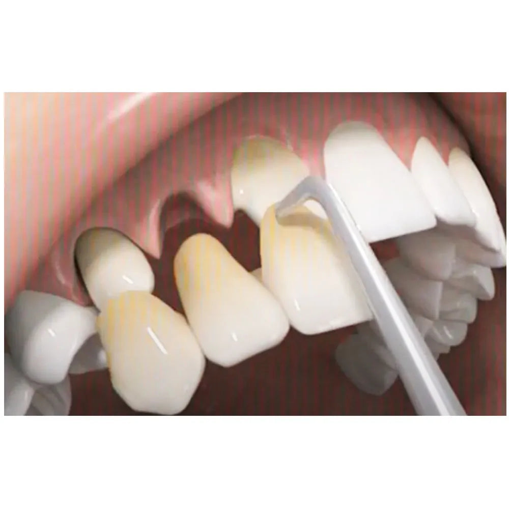GDC Automatic # Premium Crown Remover (Crp)