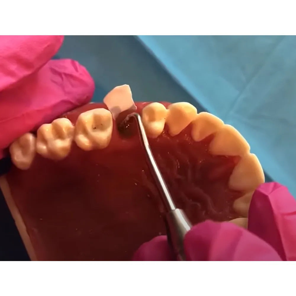 GDC Bone Grafting Instruments