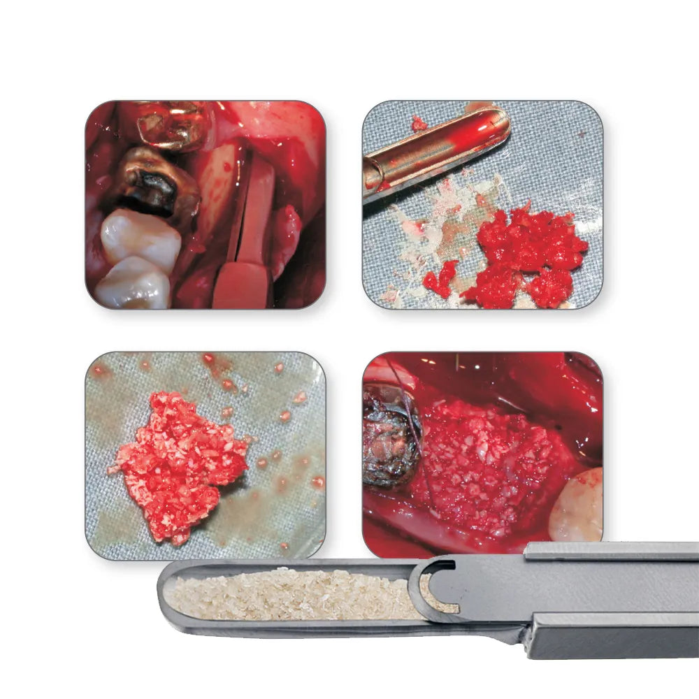 GDC Bone Scraper - Curved (Impbc)