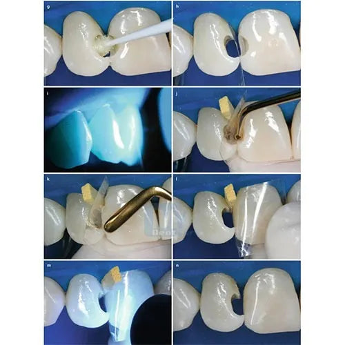 GDC Composite Instrument Gold Titanium -6 (CIG6)