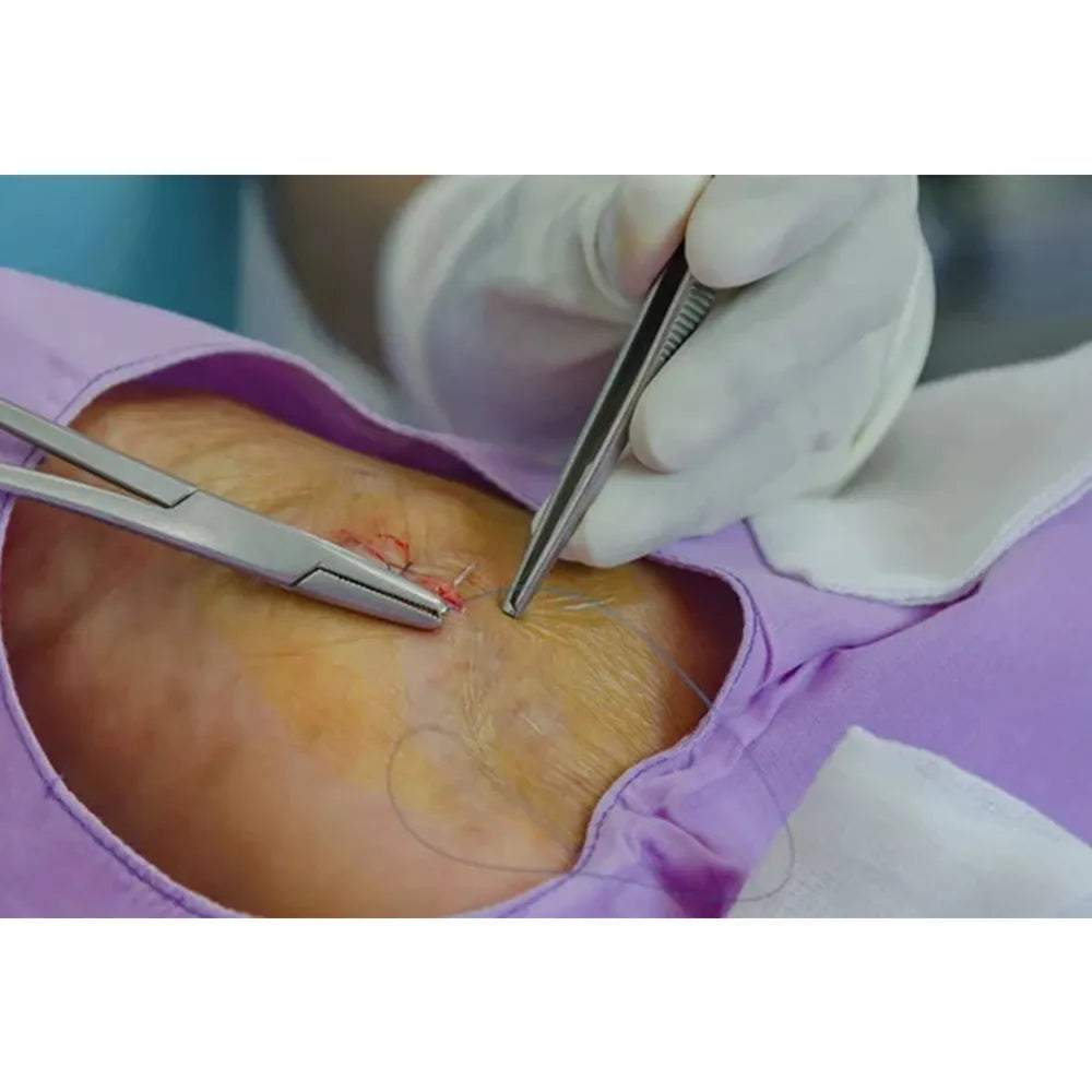 GDC Tissue Forceps