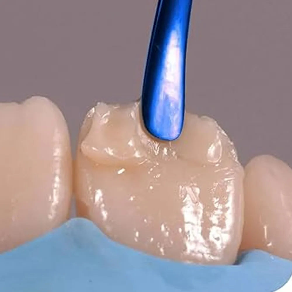 GDC Titanium Coated Composite Anterior Placing (Tncipcl)