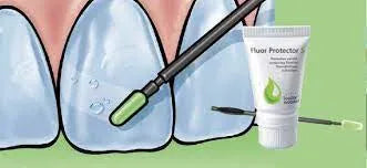 Ivoclar Fluor Protector Gel