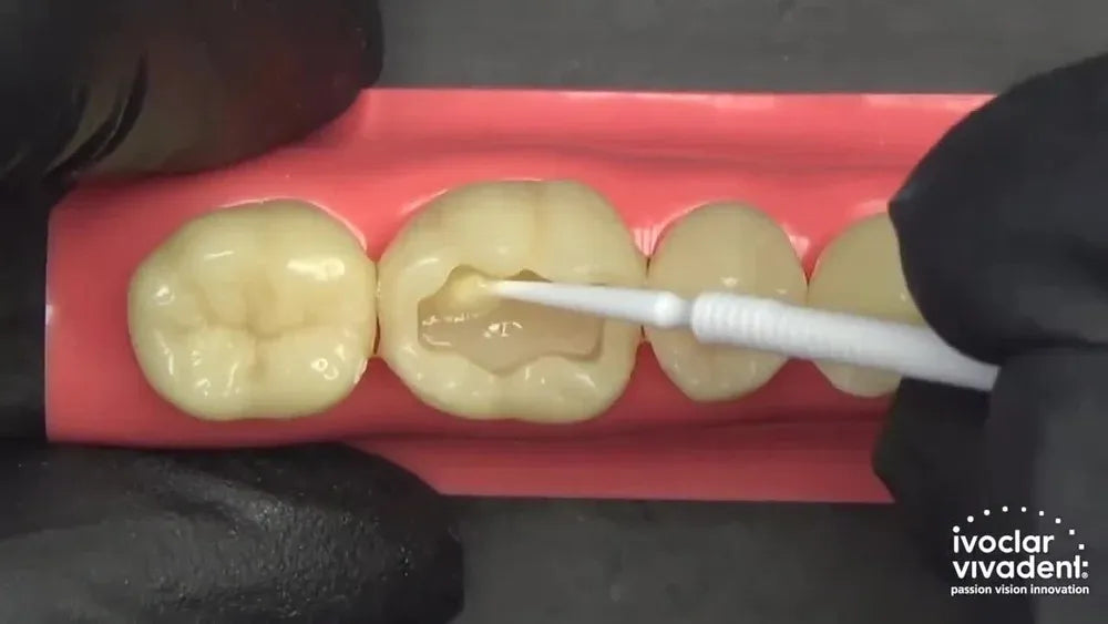 Ivoclar Tetric N-Bond Universal 3gm (Short Expiry 03-2025)