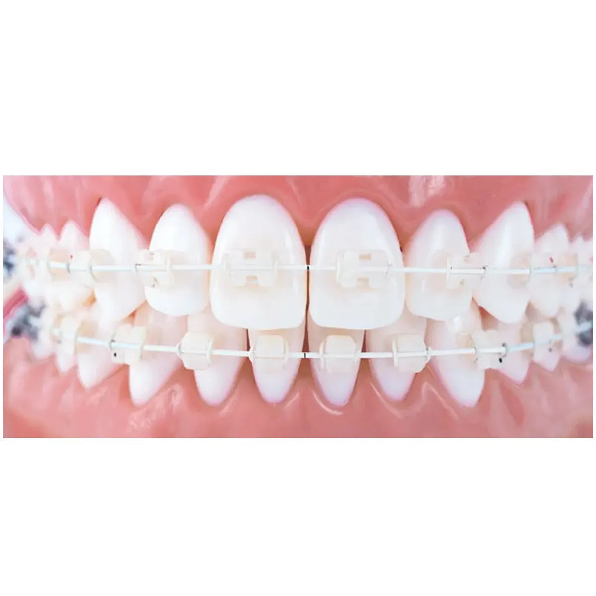 JJ Ortho Tooth Colored NiTi Archwires - Round