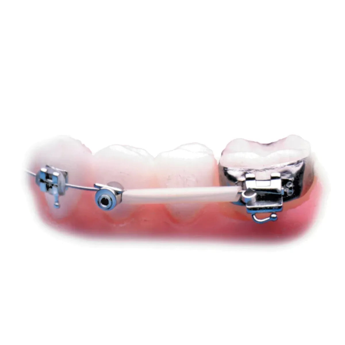 JJ Ortho Archwire Sleeves