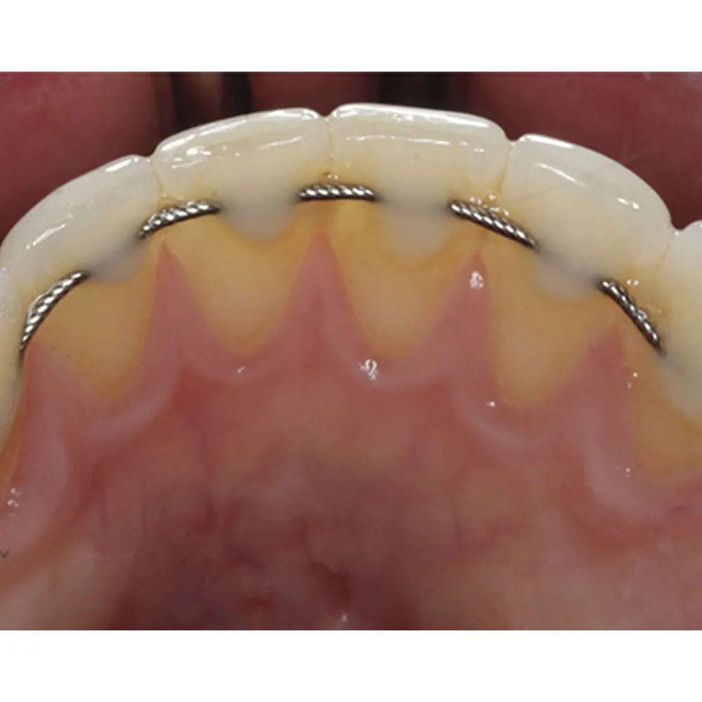 JJ Ortho Coaxial Wires