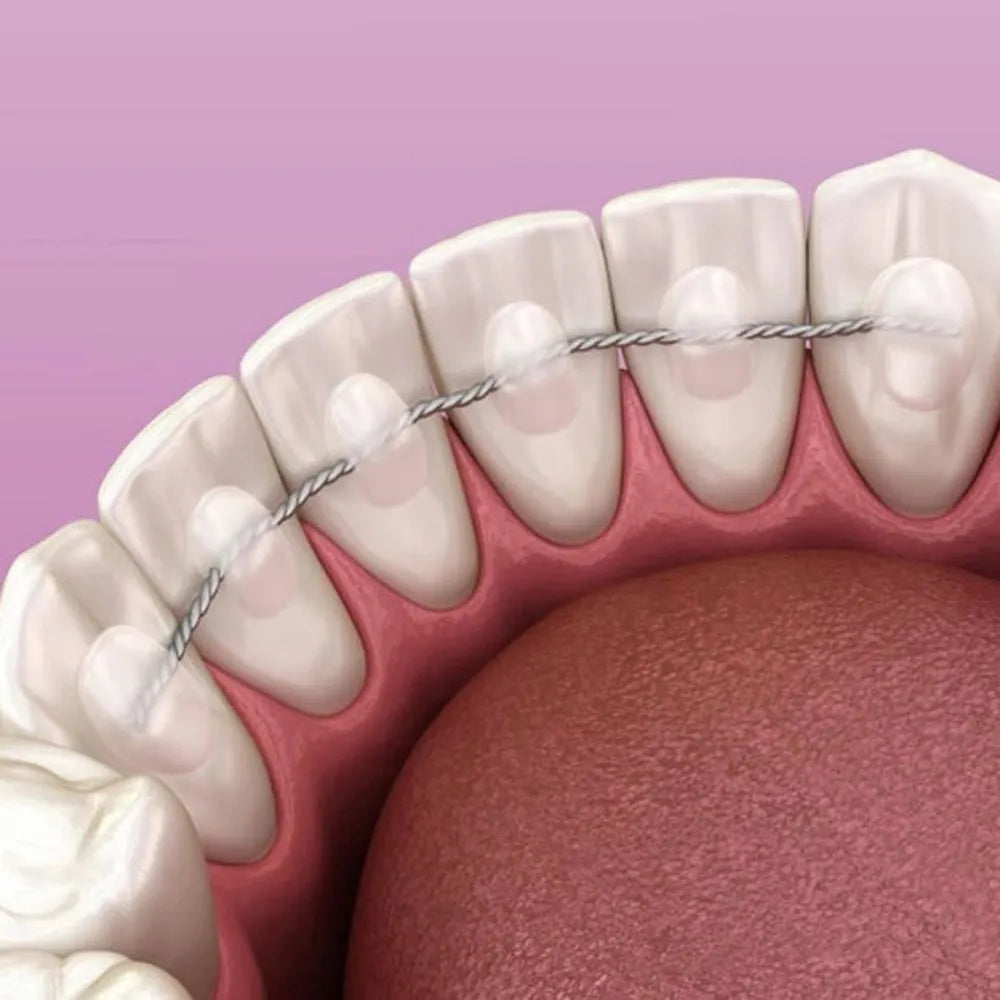 JJ Ortho Coaxial Wires