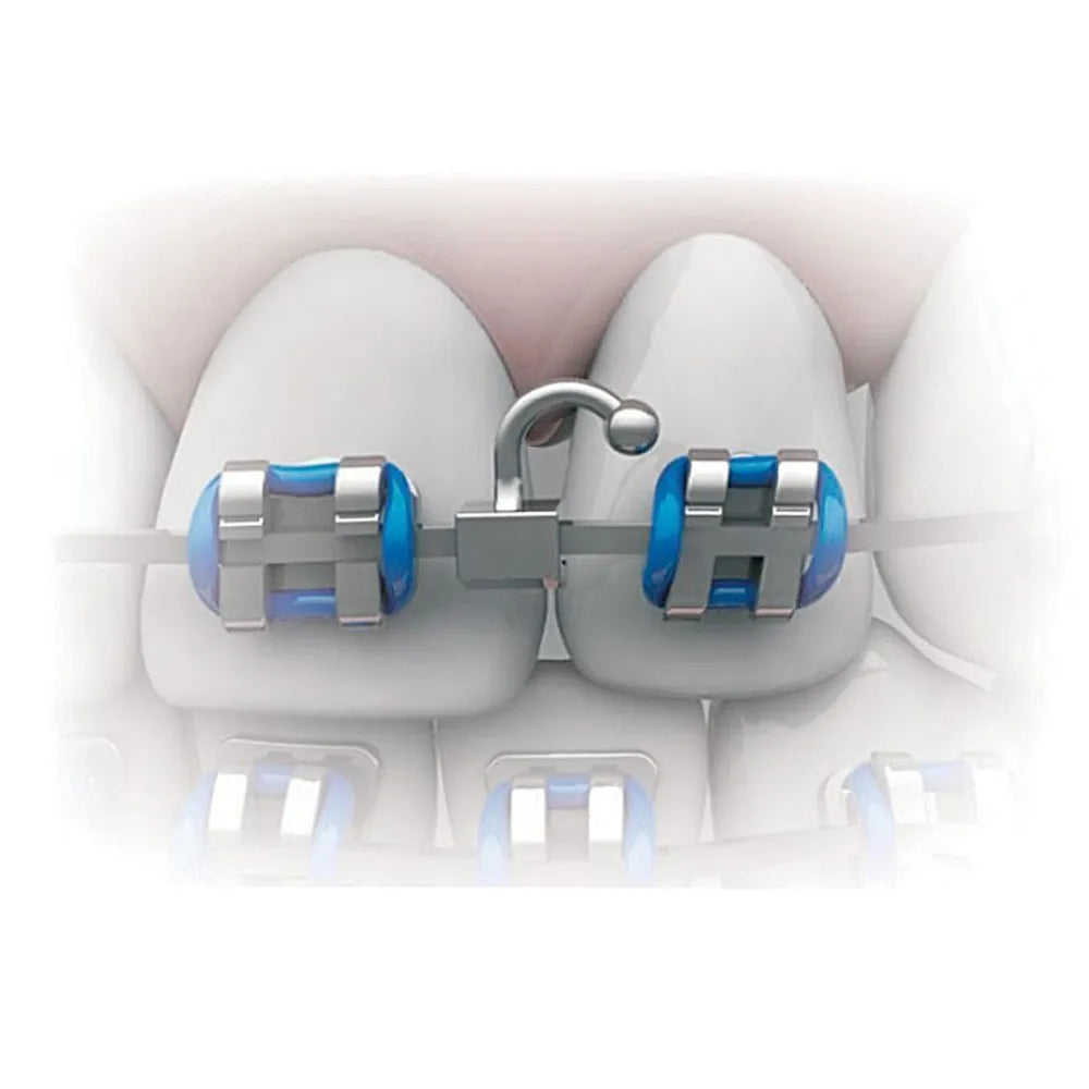 JJ Ortho Crimpable Ball Hooks Curved