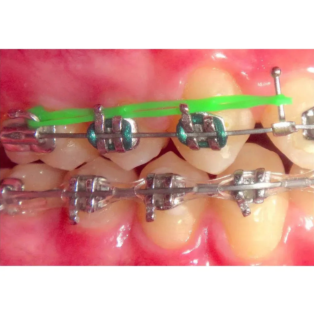 JJ Ortho Crimpable Ball Hooks Straight (60.01.54)