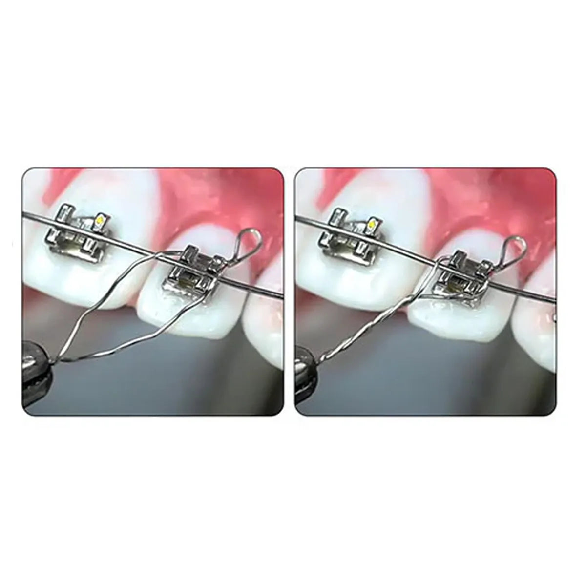 JJ Ortho Kobayashi Ligatures Wires