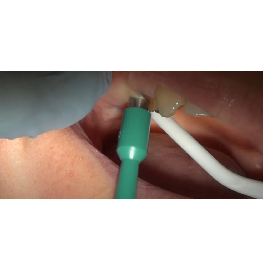 MCTBIO Tissue Punch