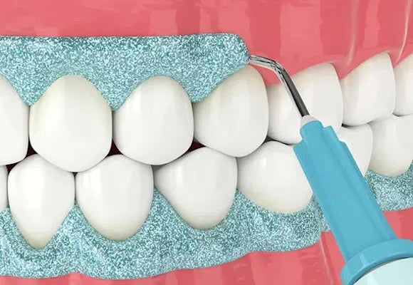 Maarc Blitz White Bleaching Kit
