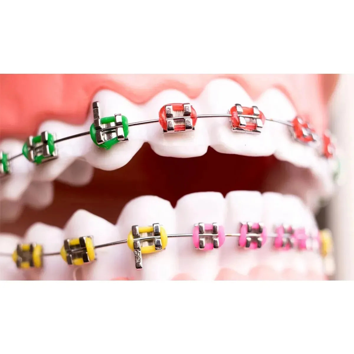 Modern Ortho Tinol-1 Superelastic Nitinol Archwires Solo - Rectangular