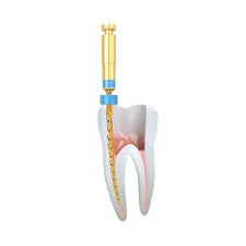 NT Gold Pro NiTi Rotary Files