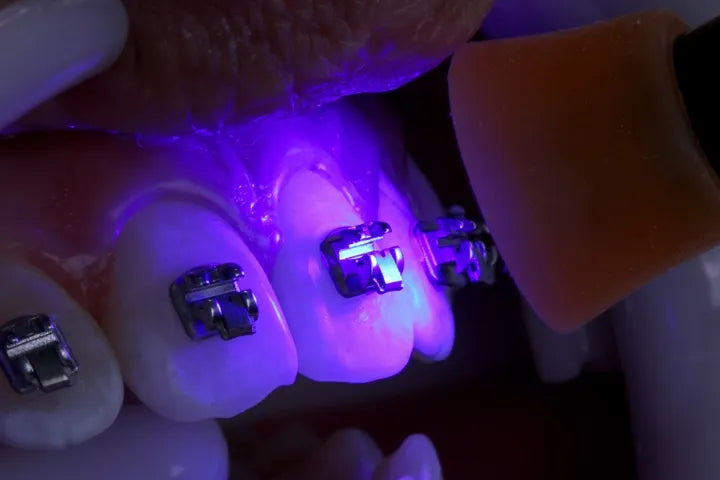 Ormco Enlight Light Cure Adhesive