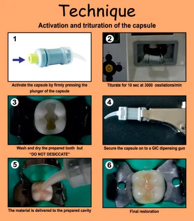 Prevest Denpro Micron Superior Capsules (30010-3)