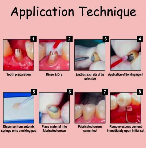 Prevest Fusion Ultra D/C- Intro Pack