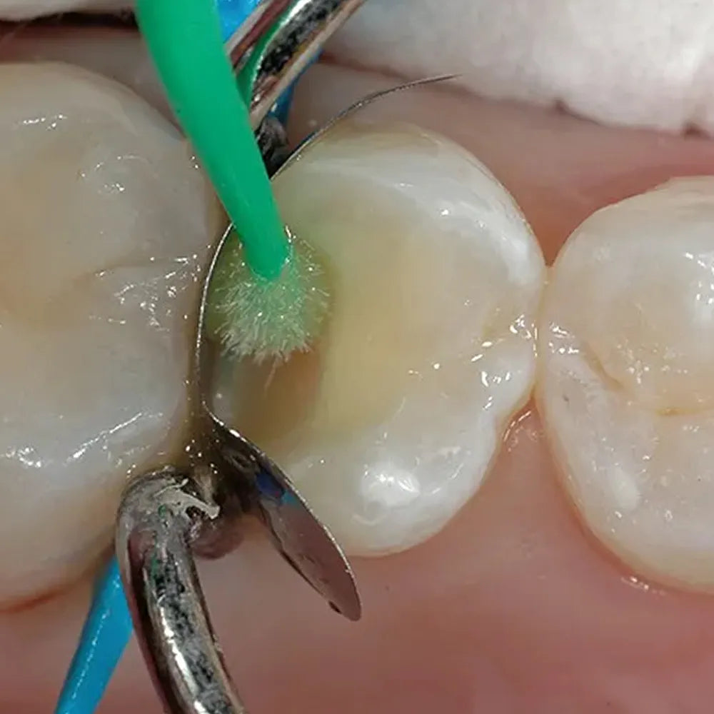 Prime Dental Restorite Bond 7G