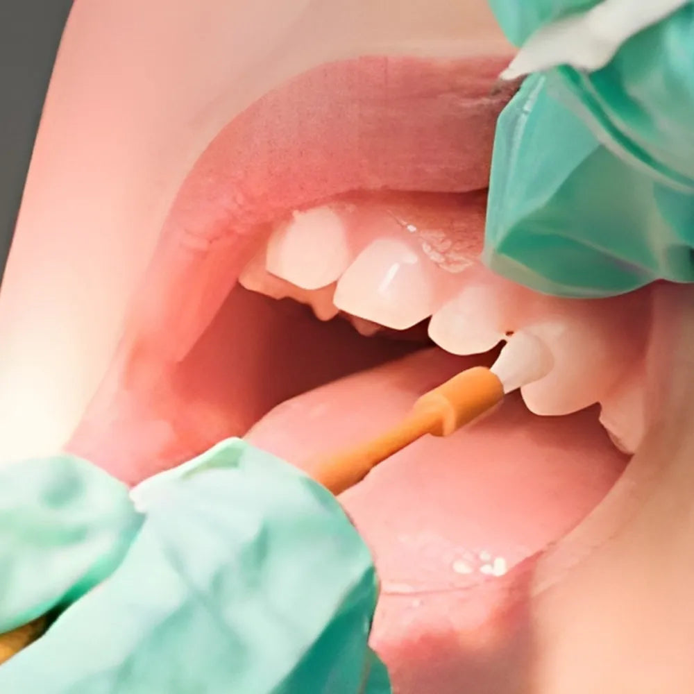 Prime Dental Restorite Desensitizer