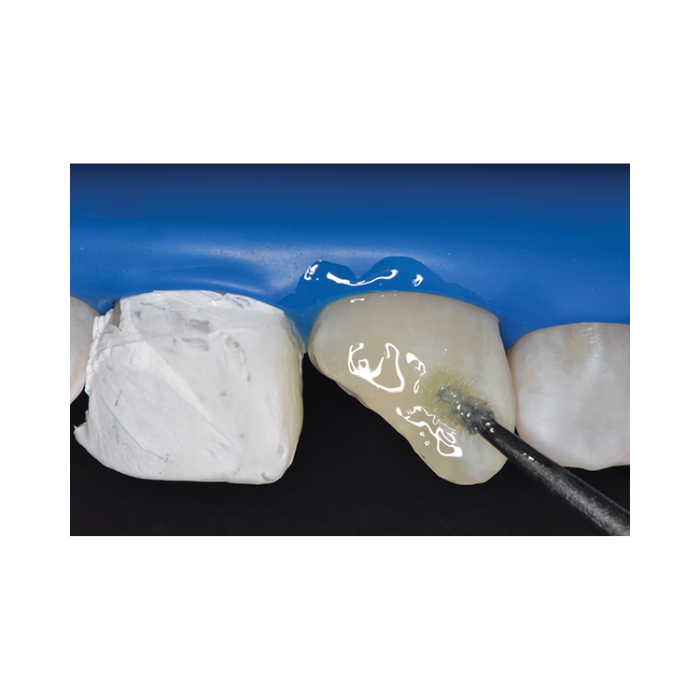 Rident R-Bond Bonding Agent