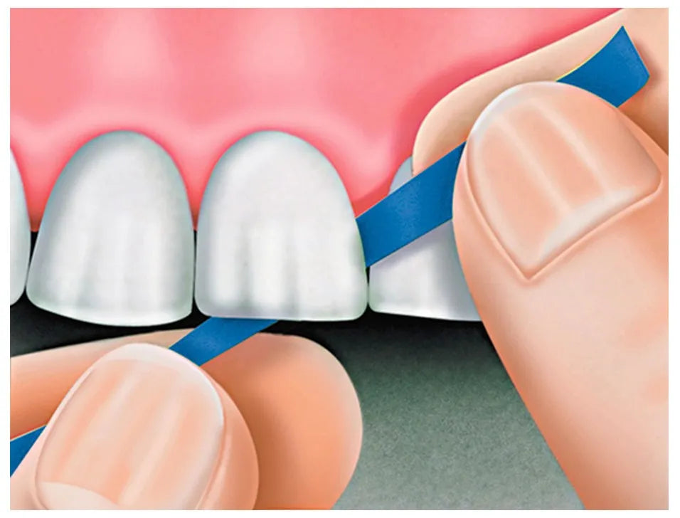 Rubydent RubyPlaton Polishing Strips