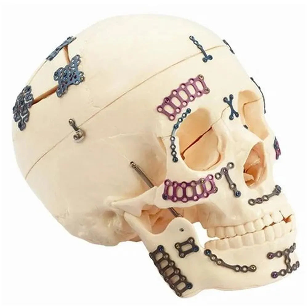 SK Surgicals SS Mini Bone Plates Orbital With Gap - 1.5mm
