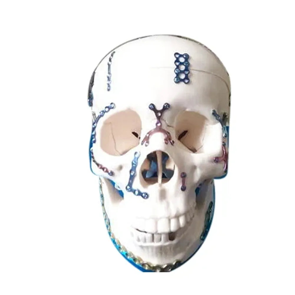 SK Surgicals SS Mini Bone Plates Y Shape - 2mm