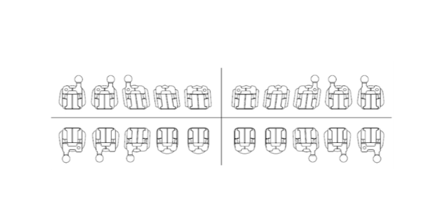 Metro Orthodontics Eco SL Pack of 20 (Wire & Instrument included) Metal Self-Ligating Brackets