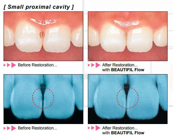 Shofu Beautifil Flow F02 Refill