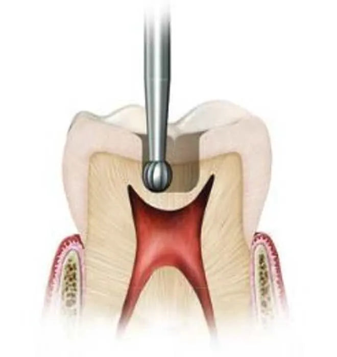 Ss White Surgical Length Carbide Fg Burs