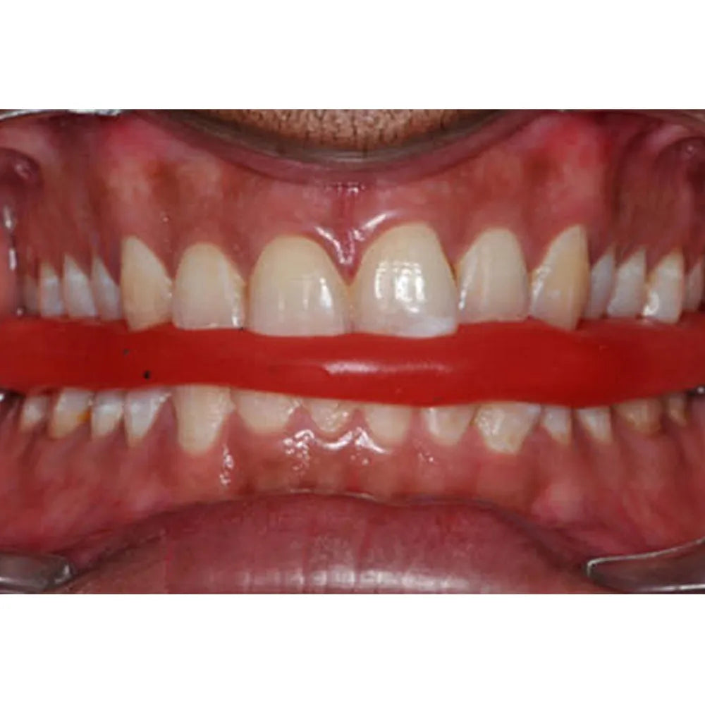 This brand is not  found in dentalkart