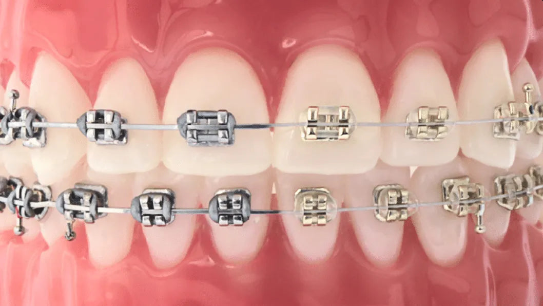 U Ortho NiTi Archwire -Ovoid(pack of 10)