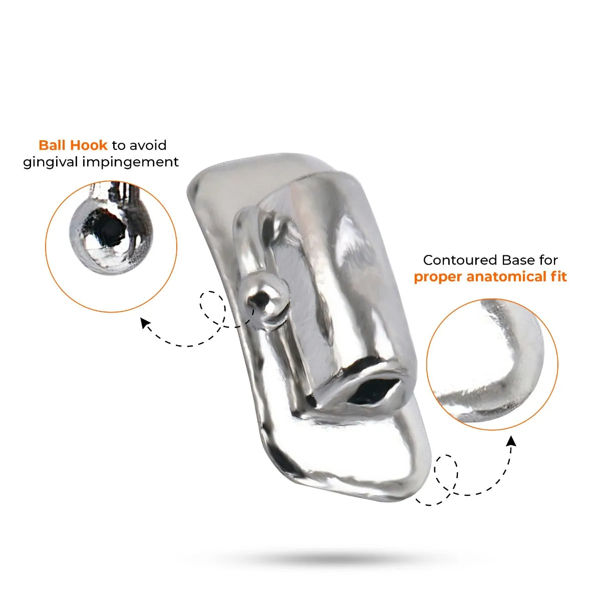 U Ortho Bondable Buccal Tubes - 2nd Molar MBT 0.022