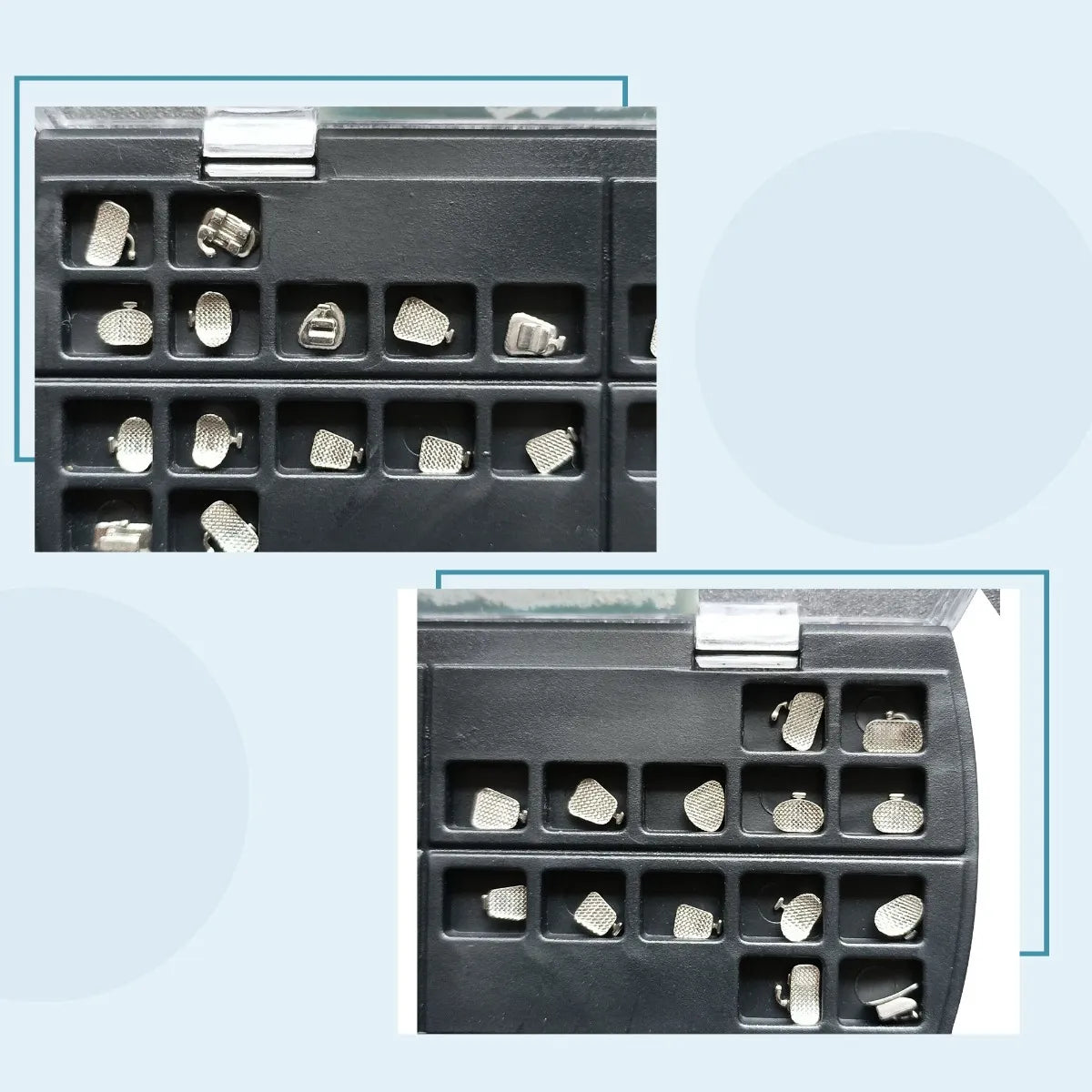 U Ortho Lingual Brackets 018