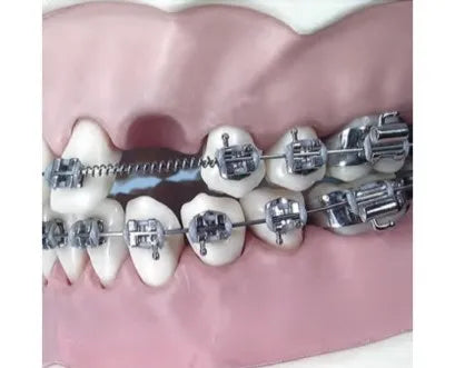 U Ortho NiTi Open Spring Spool 0.010" 900mm