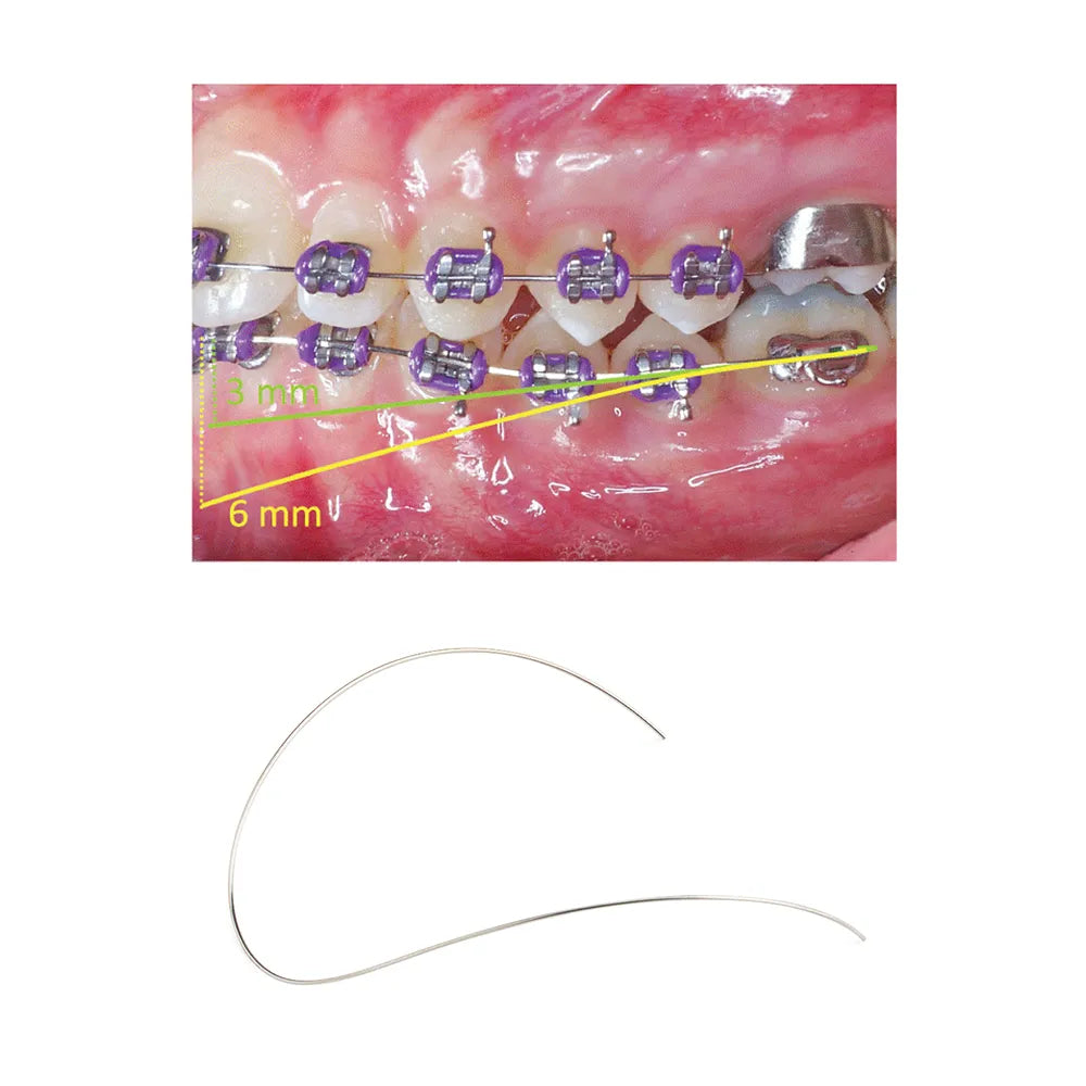 U ortho Niti Reverse Curve Arch Wire-Ovoid
