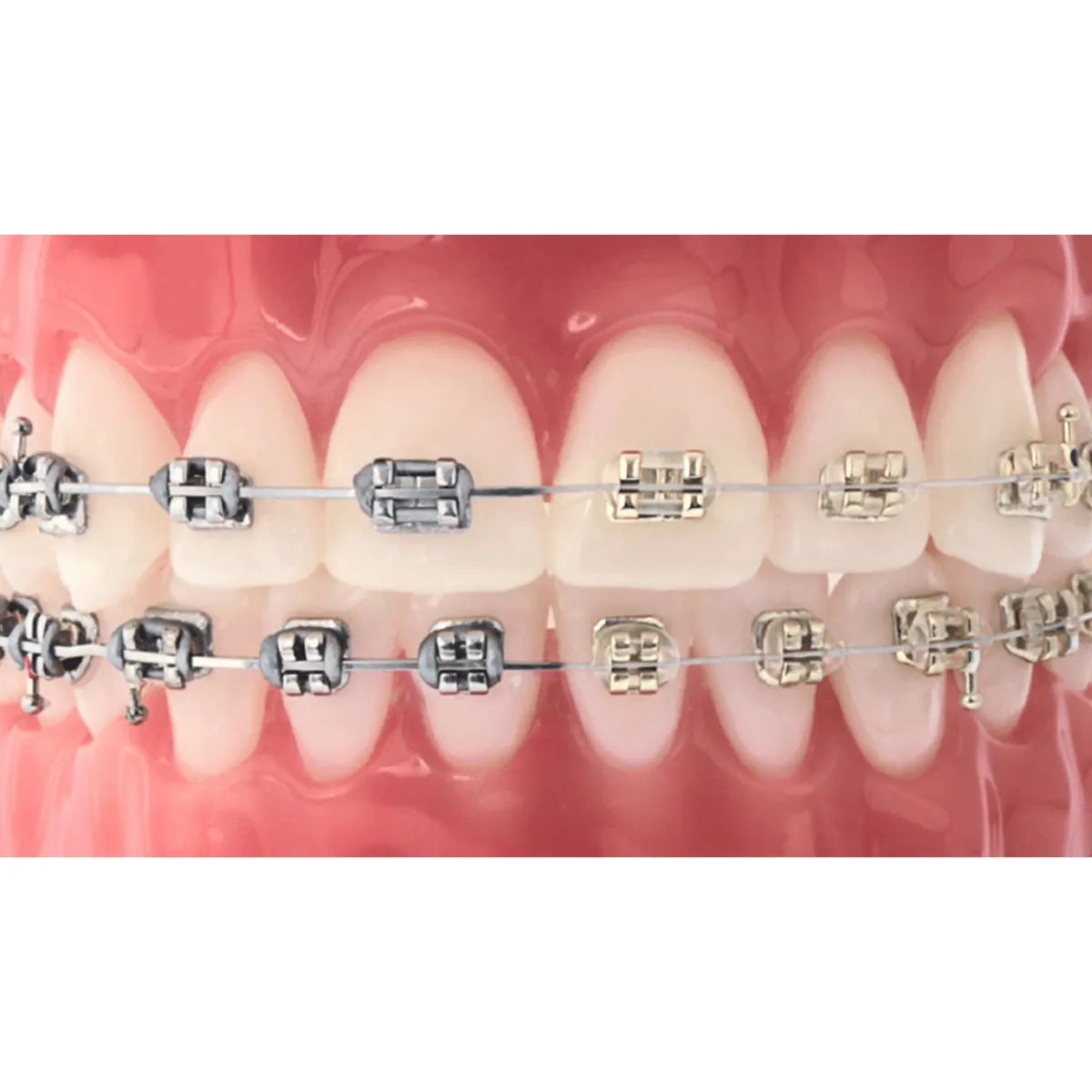 U ortho ligature Ties