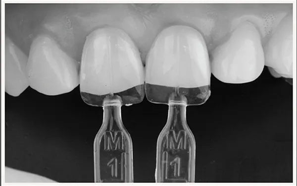 Ultradent Uveneer Template Refills