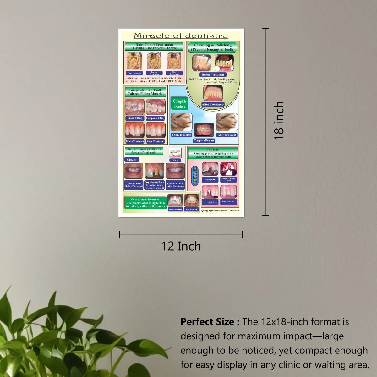 Unique Dents Dental Education Posters (DWP01) - Set Of 6
