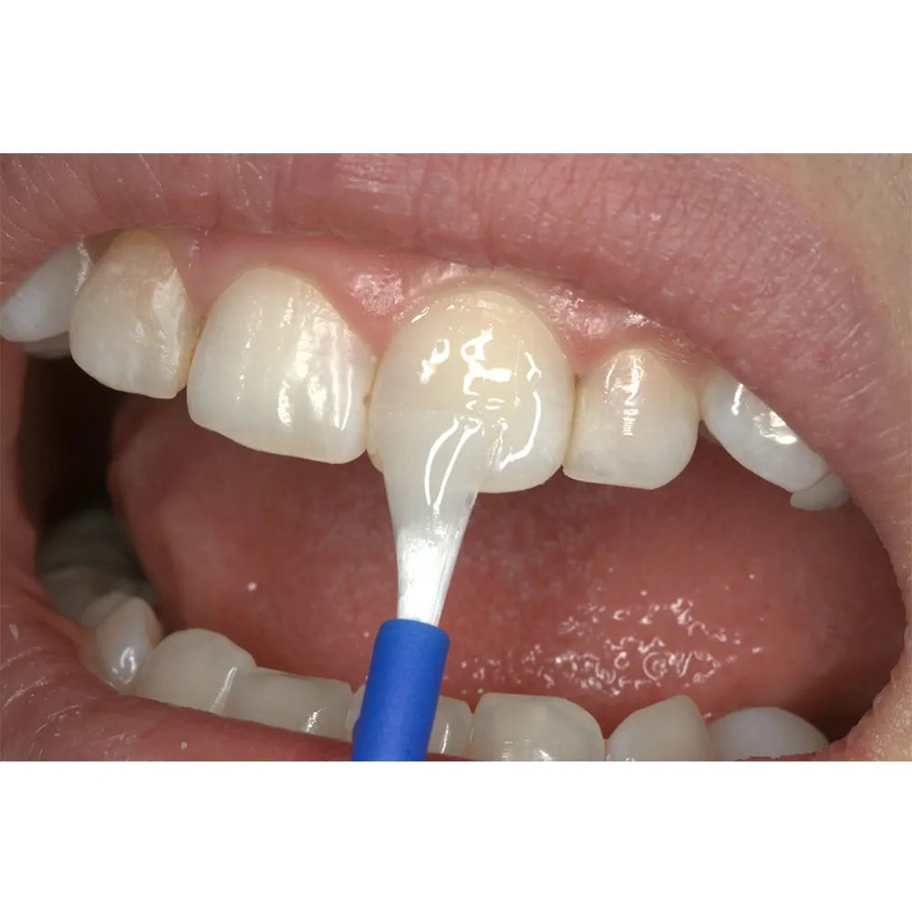 Voco Profluorid Varnish - Single Dose Refills