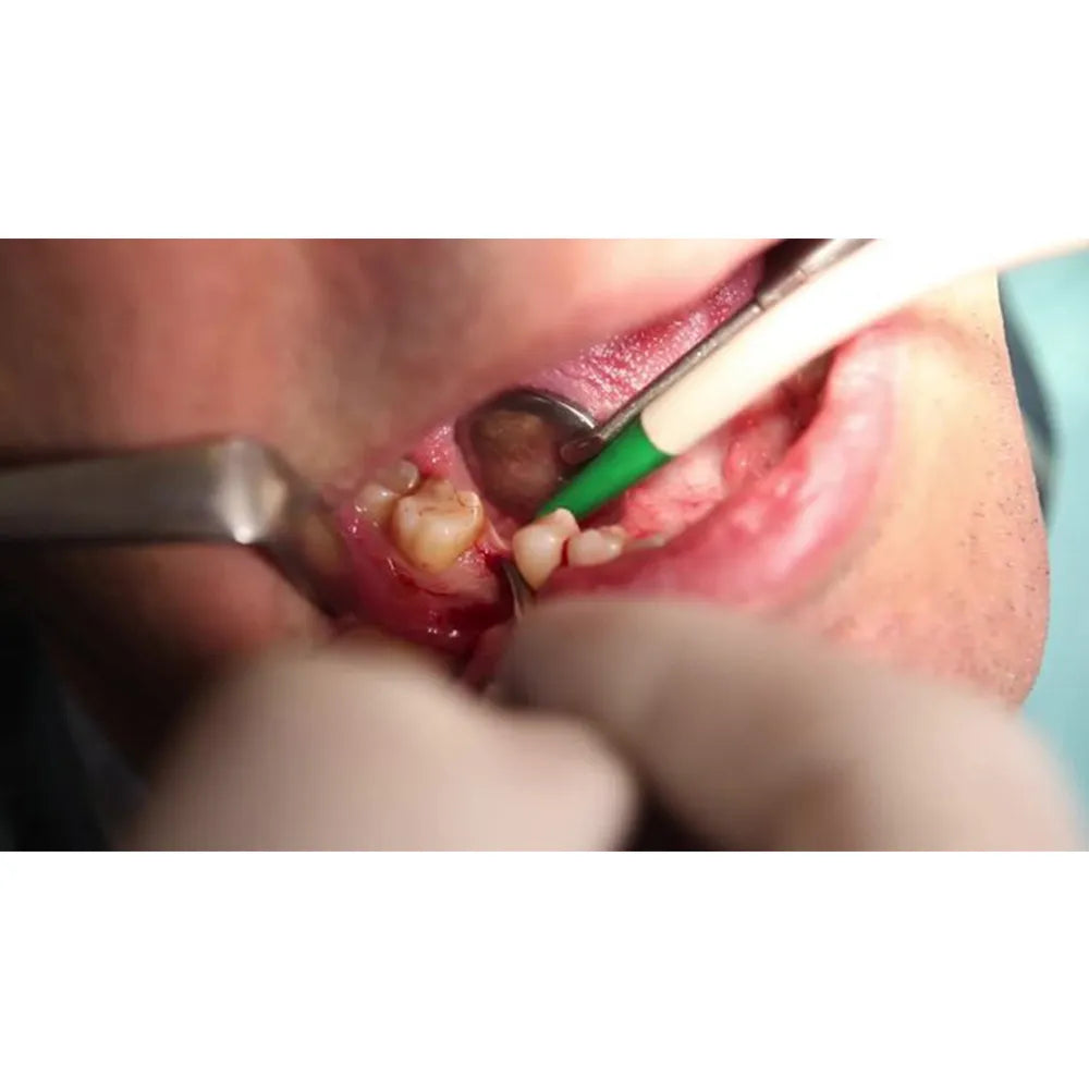 GDC Austin Cheek Retractor Halfmoon (Tra3)